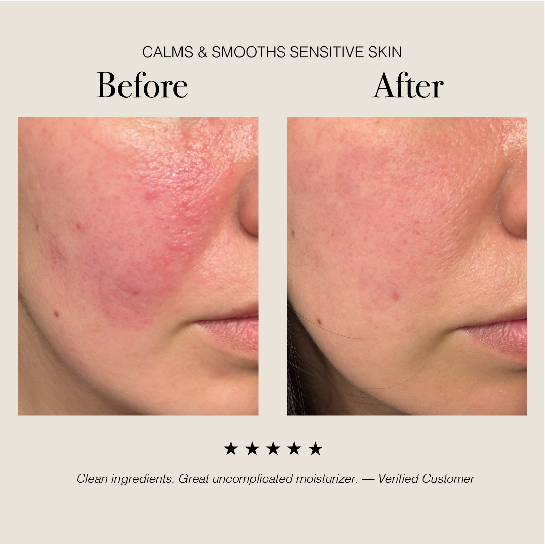 Hyaluronic Acid + Ucuuba Butter Face Cream for Hydration & Glow