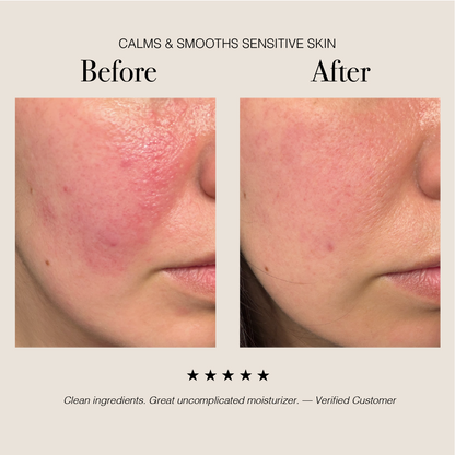 Hyaluronic Acid + Ucuuba Butter Face Cream for Hydration & Glow